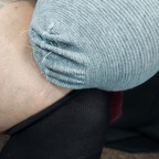 notoesnoleftleg (QueenUniPed) free OnlyFans content 

 profile picture